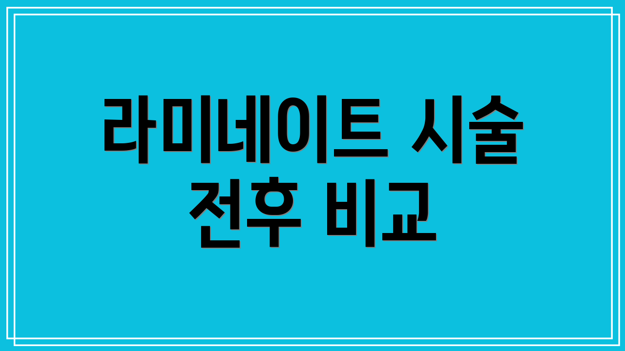 라미네이트 시술 전후 비교